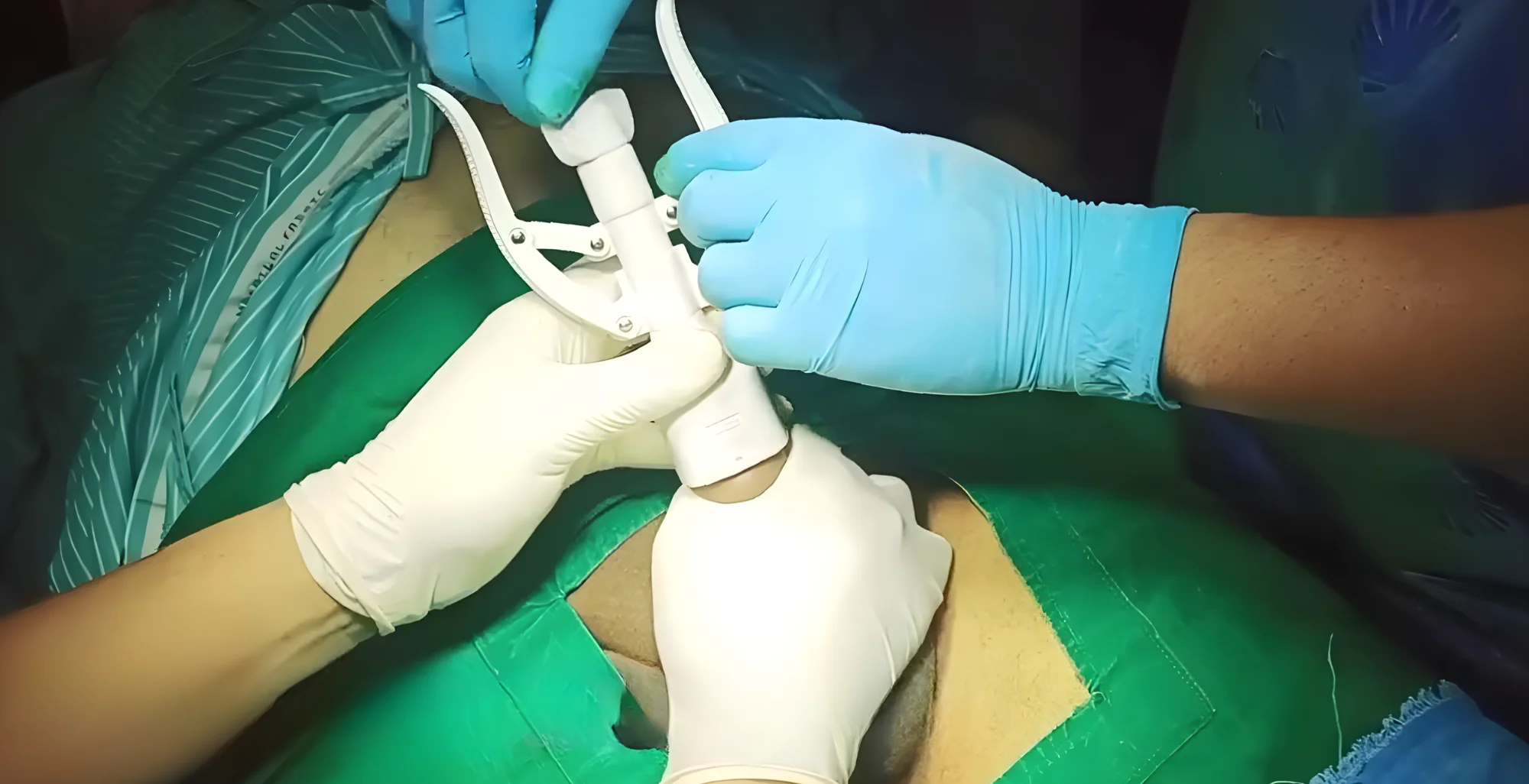 Dr. MD. Sabir Pasha - Laser & Stapler Circumcision Specialist